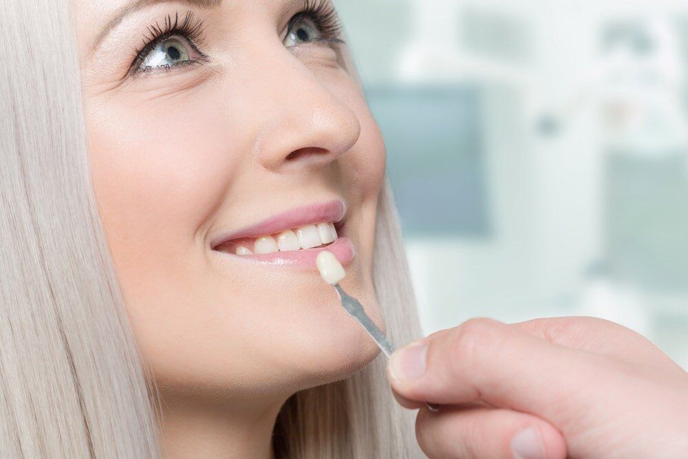 Woman with Veneers on Teeth — Dental Services in Gympie, QLD