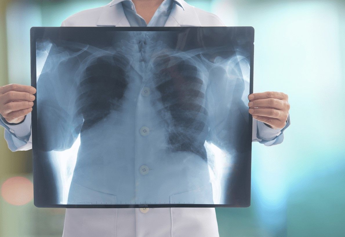 Xrays and Radiology | Lutz, FL | Advanced Optimal Healthcare