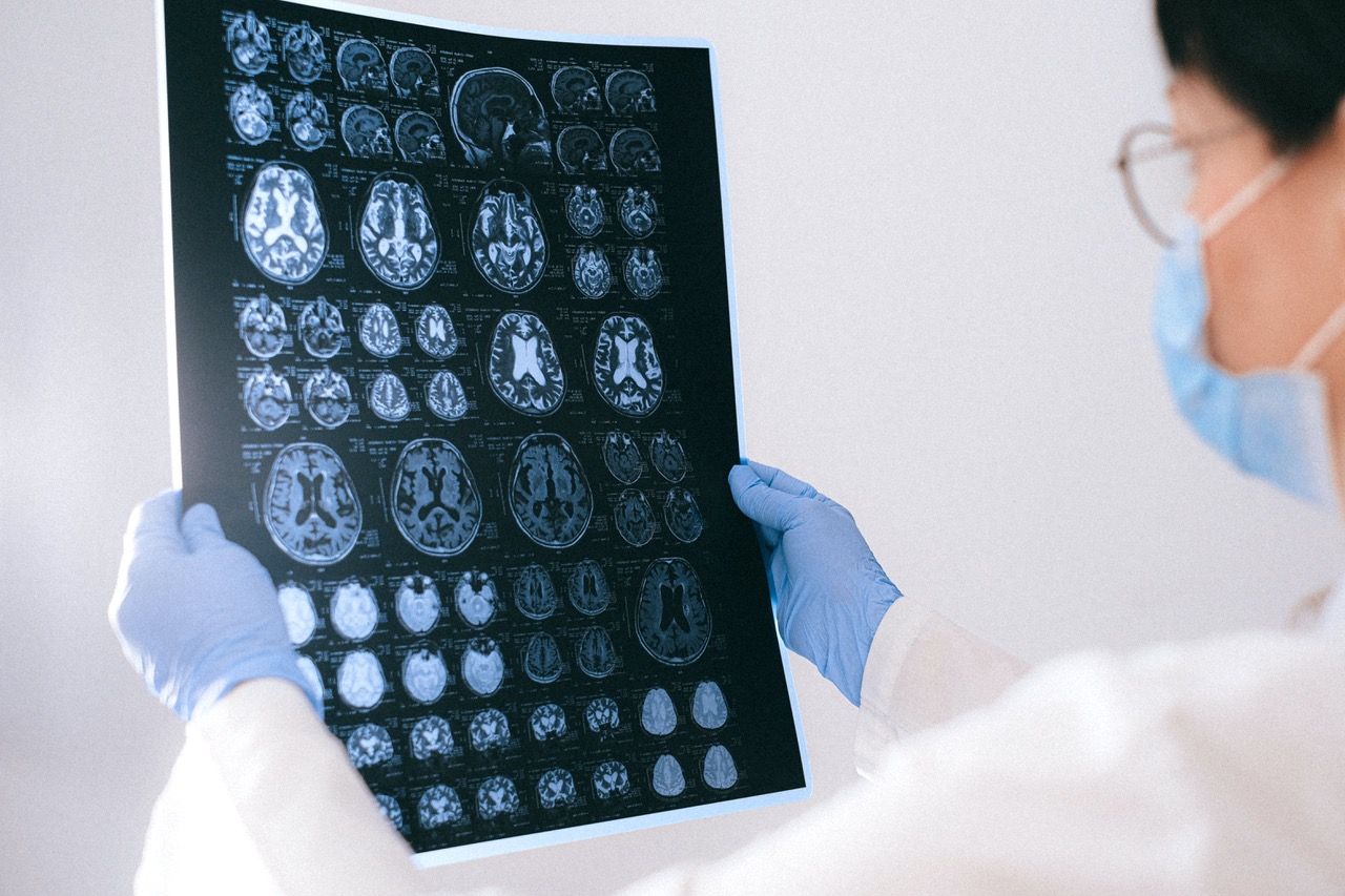 A doctor wearing a mask and gloves is looking at a brain scan