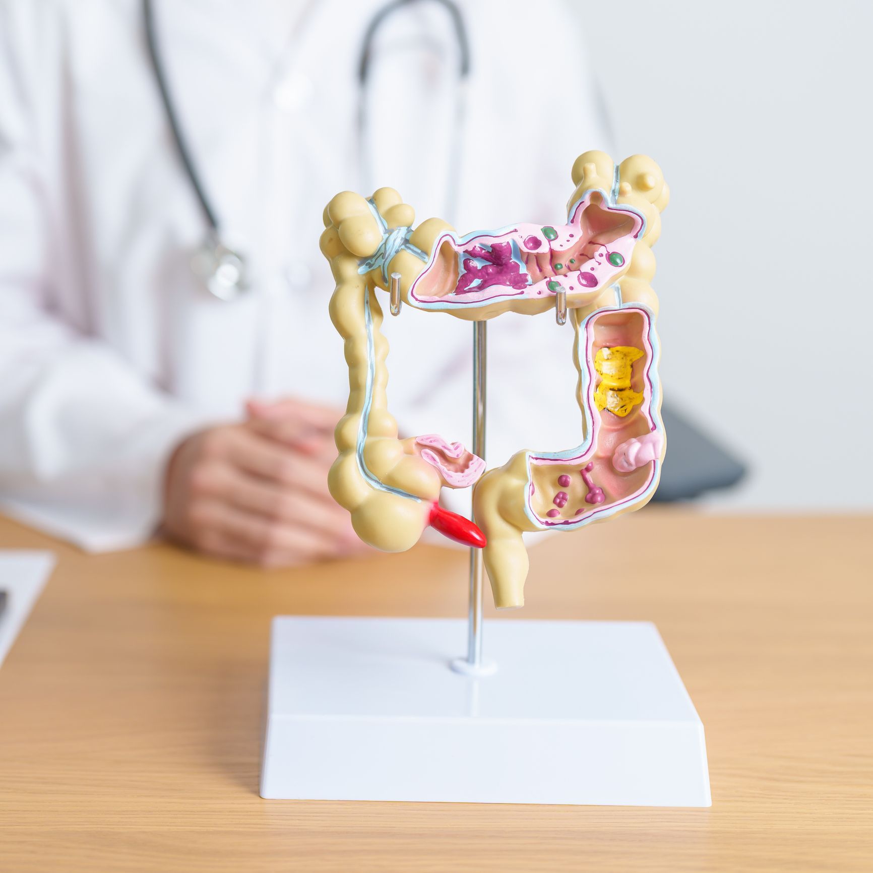 Doctor with colon anatomy model representing colon cancer care in 
Anchorage, AK