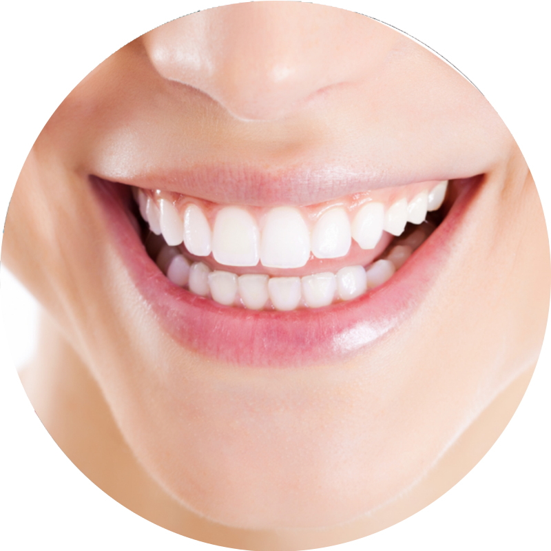 A close up of a woman's smile with white teeth
