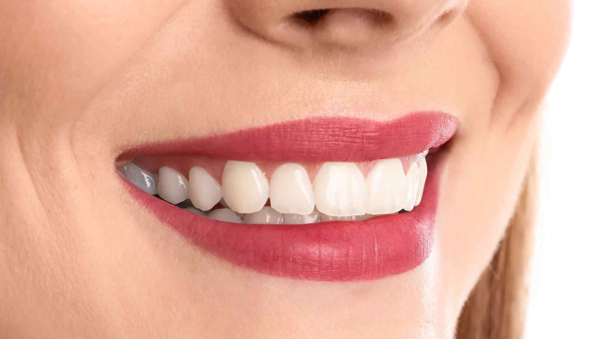 A close up of a woman's smile with white teeth and red lipstick.
