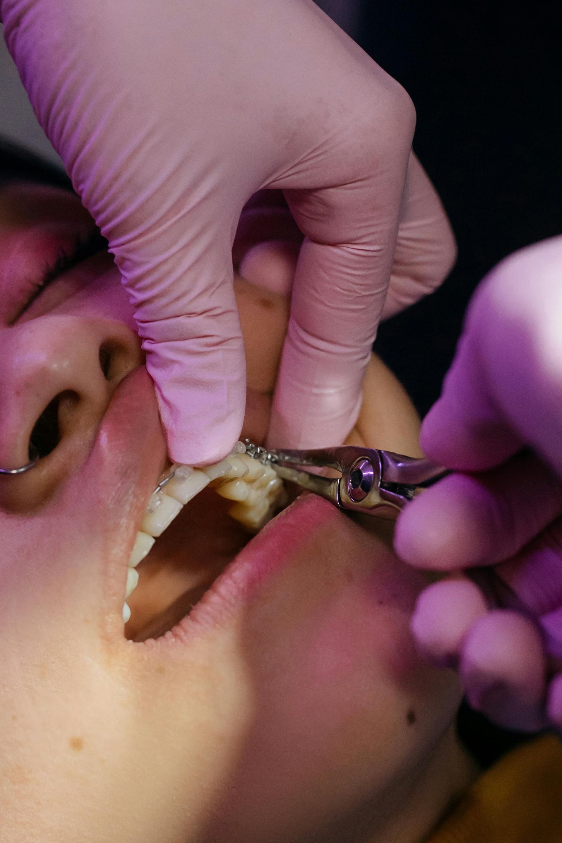 A person is getting their teeth examined by a dentist.