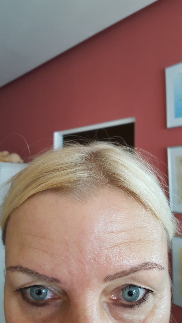 Eine Nahaufnahme der Stirn einer Frau mit blauen Augen und blondem Haar.