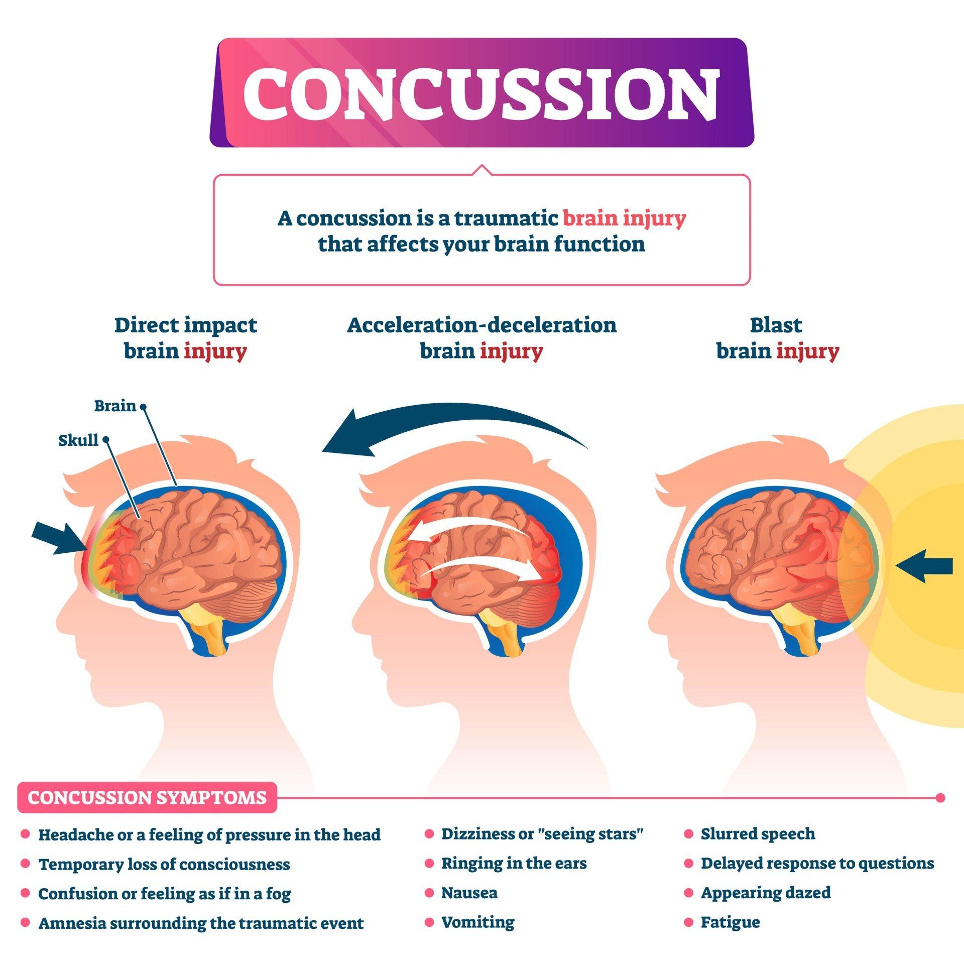 All about concussion