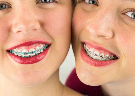 Two Girls with Braces - Family Orthodontist in Tonawanda, NY