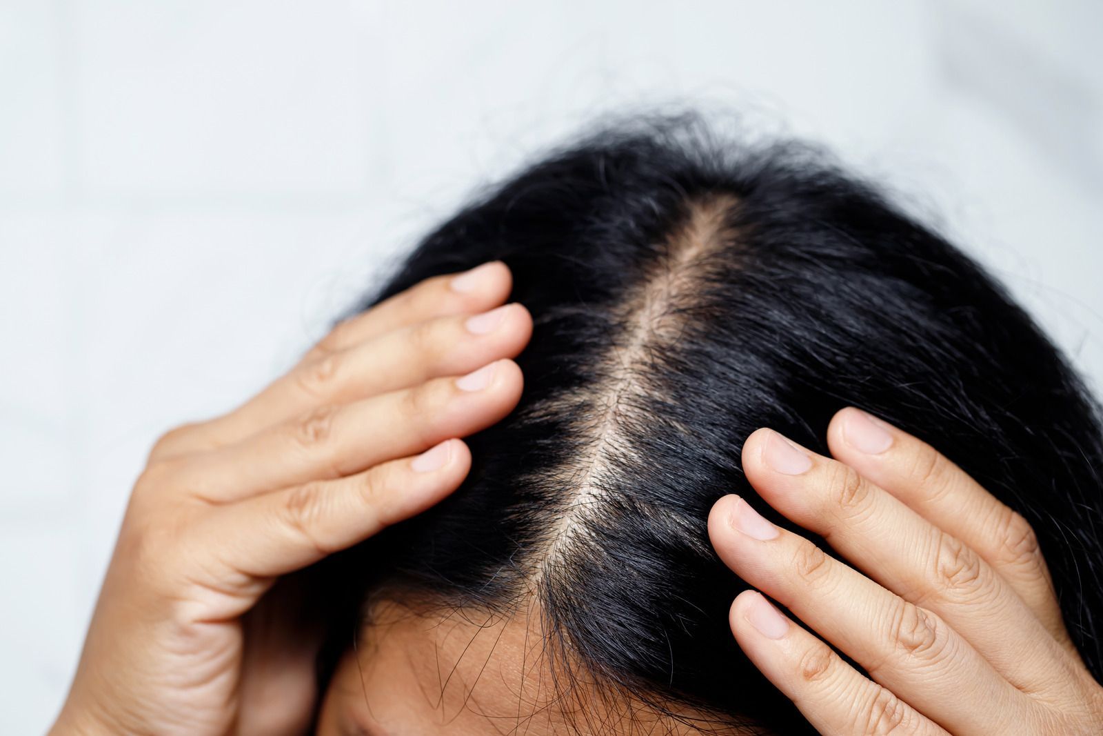 Person's hands examining parting of dark hair, revealing the scalp.