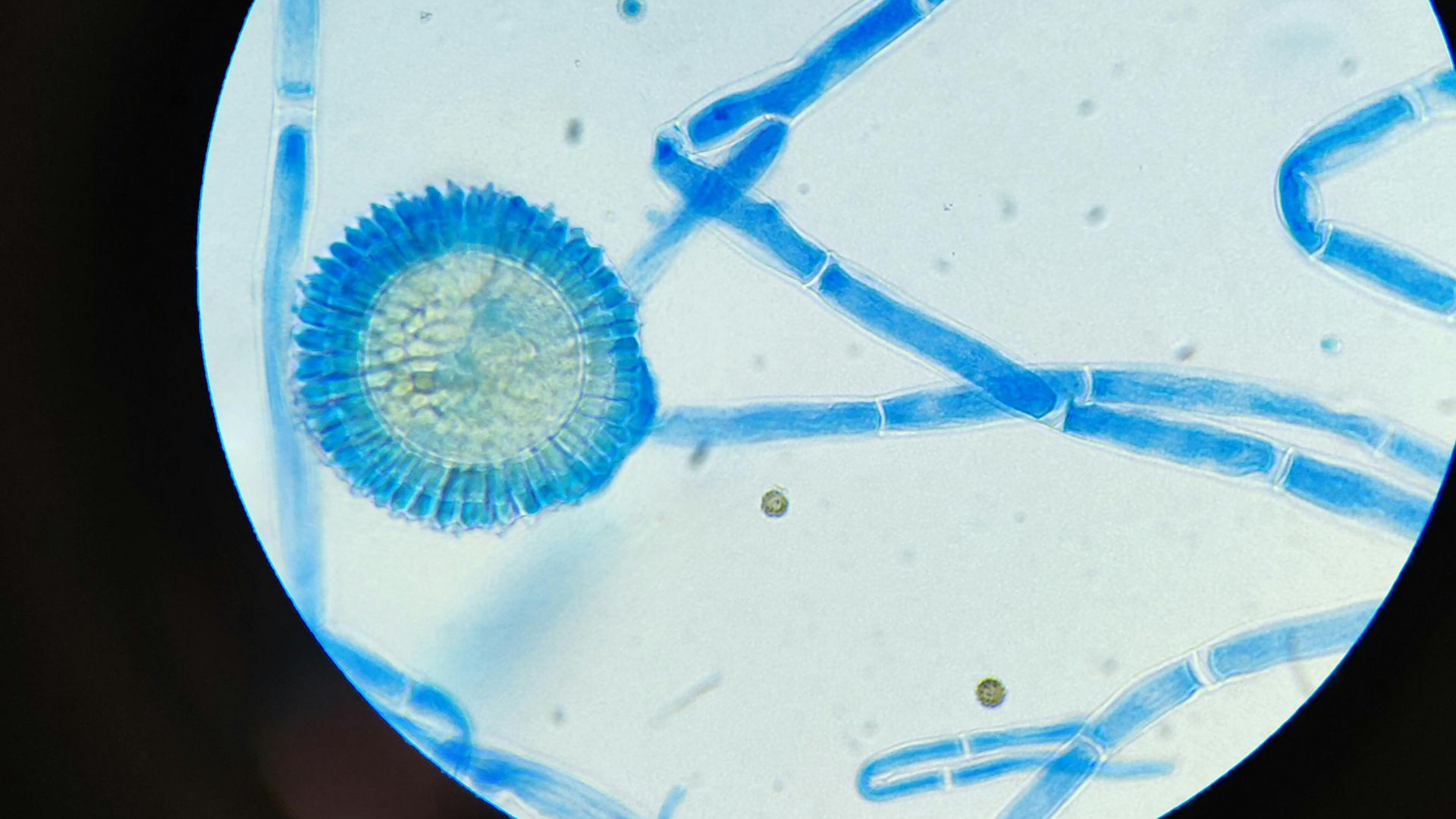 Microscope view of blue fungal filaments and a round spore head on a white background
