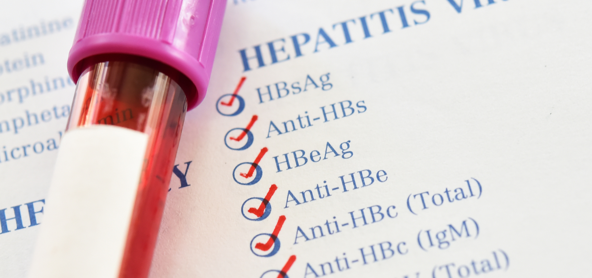 A blood draw test tube next to  a checklist of antigens for Hepatitis testing.