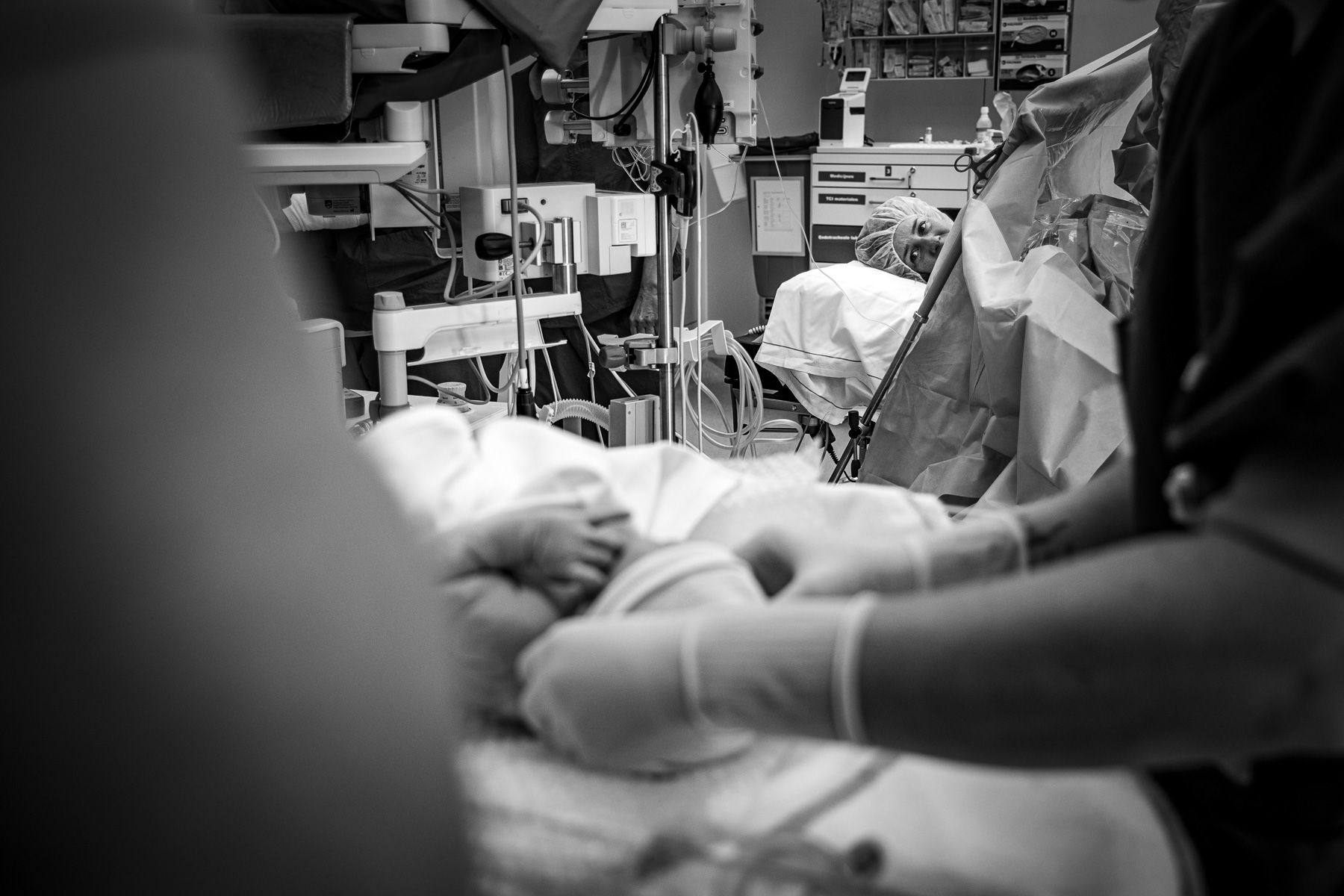 Baby wordt geboren via een keizersnede in de operatiekamer van het ziekenhuis.
