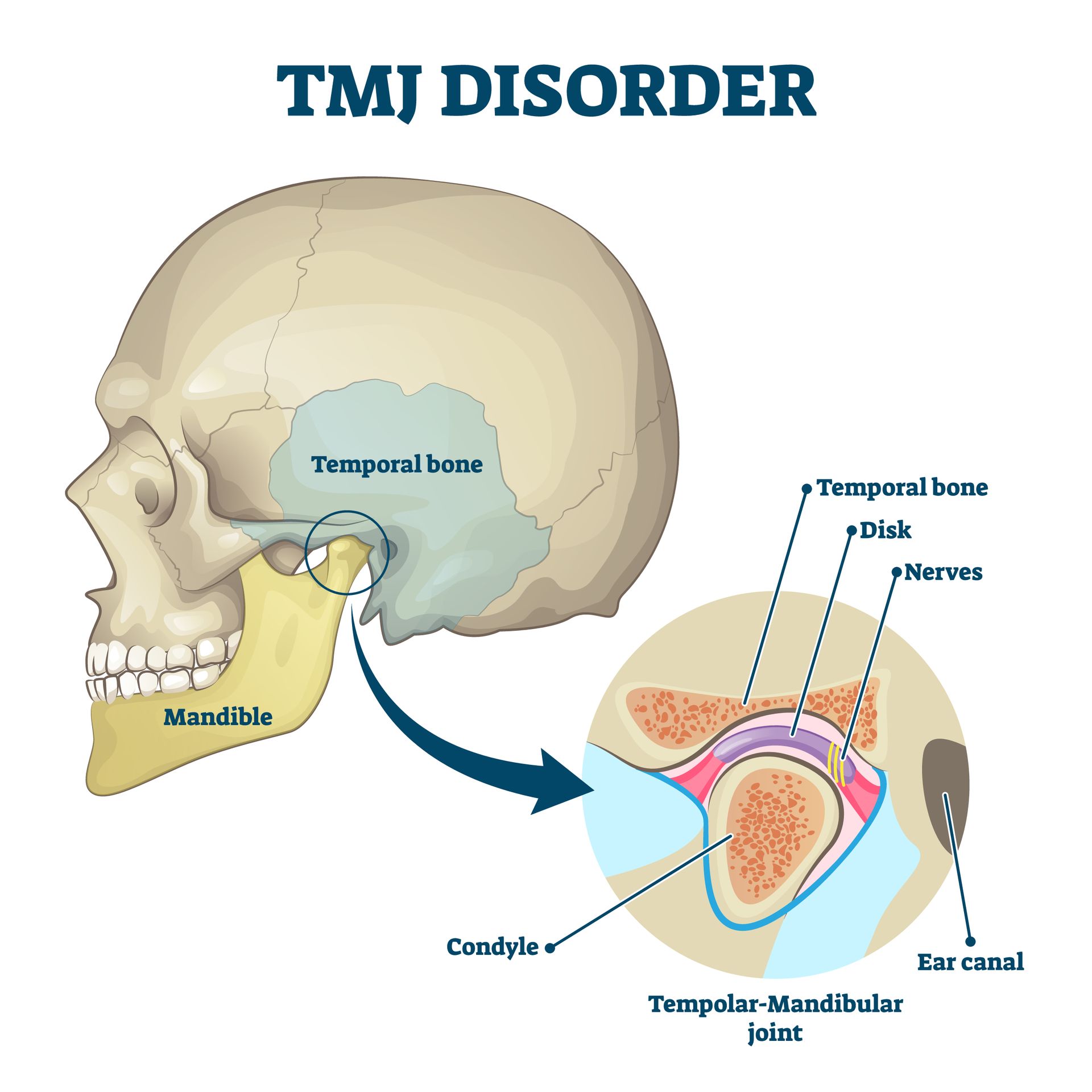 Jaw and Temporomandibular Joint: Anatomy