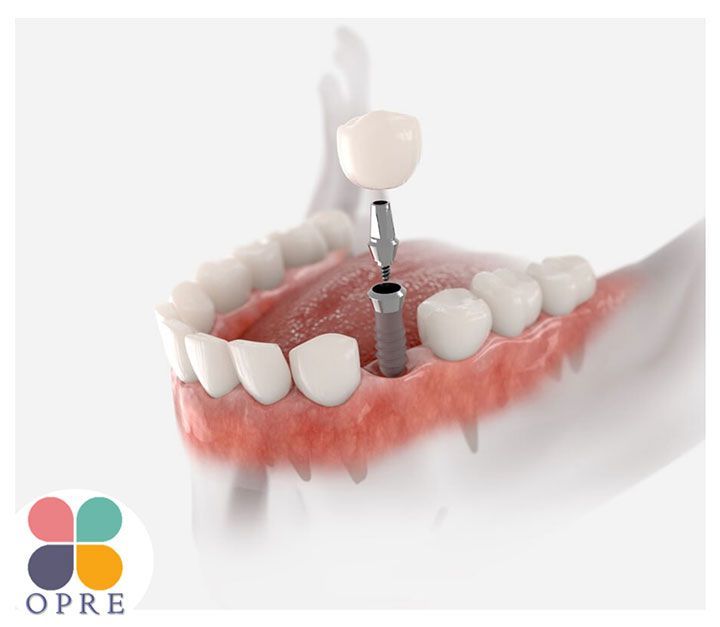 OPRE DENTAL