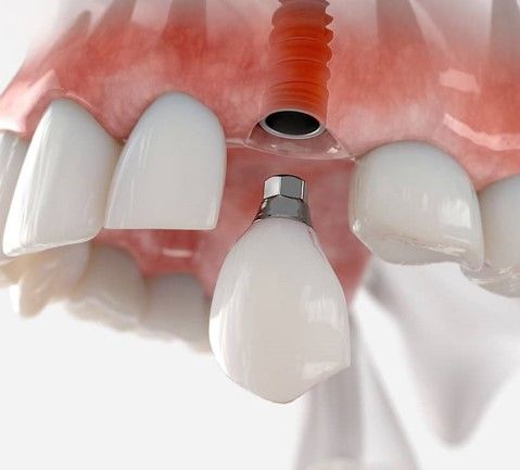 OPRE DENTAL
