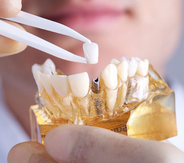 OPRE DENTAL