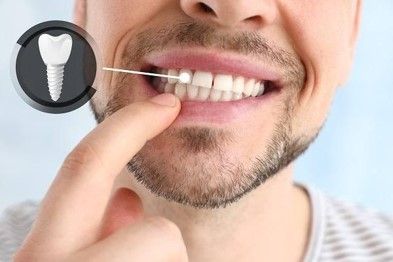 OPRE DENTAL
