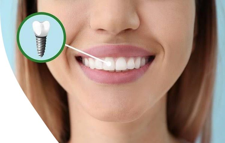OPRE DENTAL
