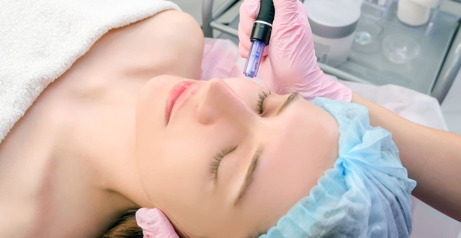 Microneedling for anti-aging