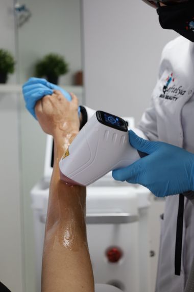 Permanente ontharing voor vrouwen bij Eftelya Beauty Salon