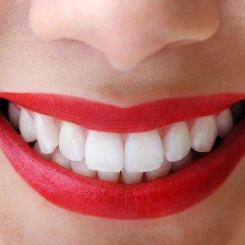 view of white teeth and red lips