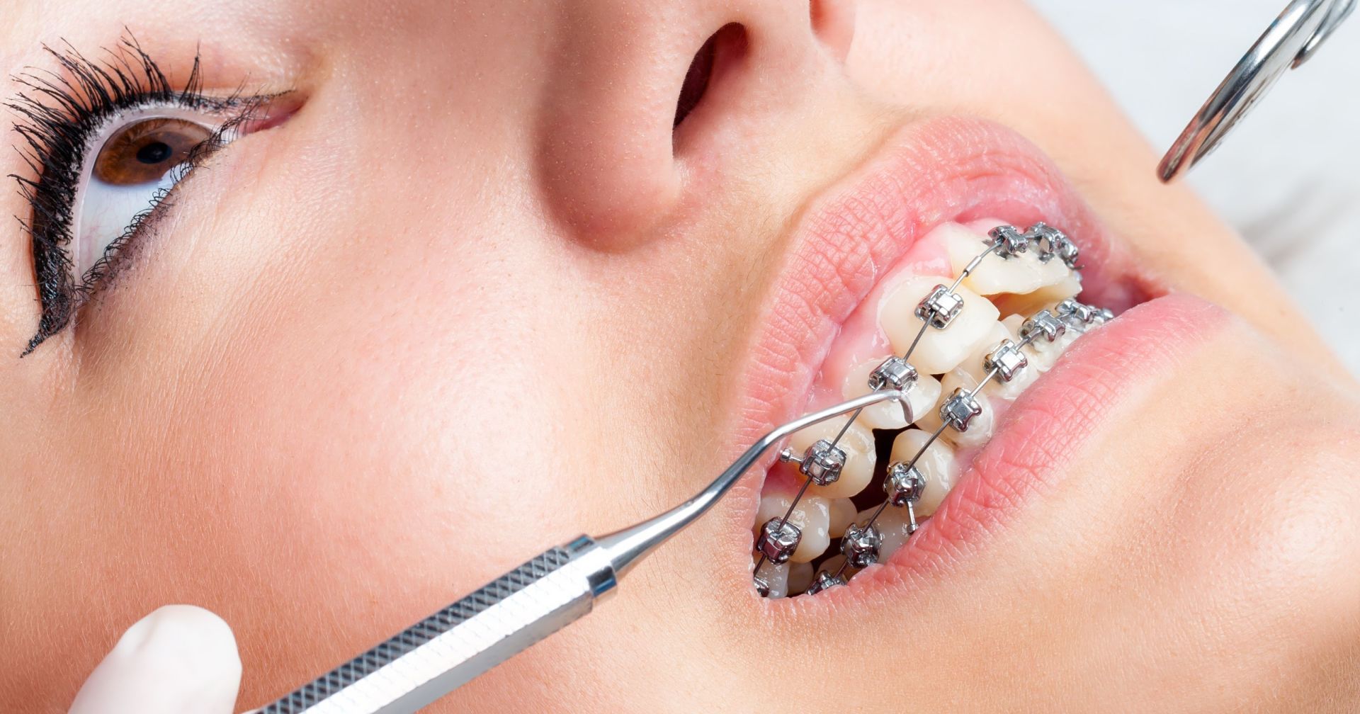 Senior Citizen Dentist Dansville, NY Dansville Family Dental Care