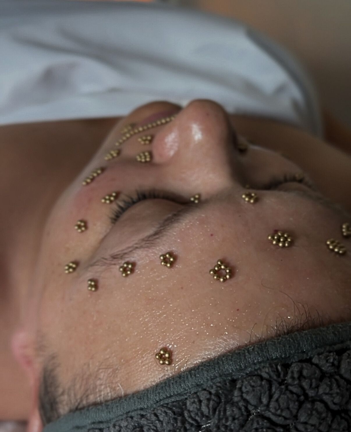 A woman has gold micro magnets on her face. 