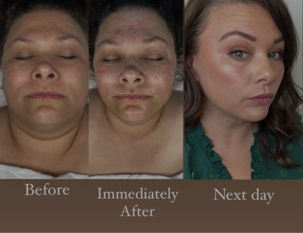 A woman 's face is shown before immediately after and next day