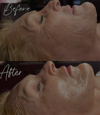 A before and after photo of a woman 's face