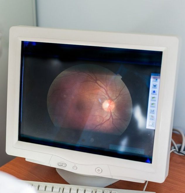 A Computer Monitor With a Picture of an Eye on It — Ian Emslie Optometrist In Warners Bay, NSW