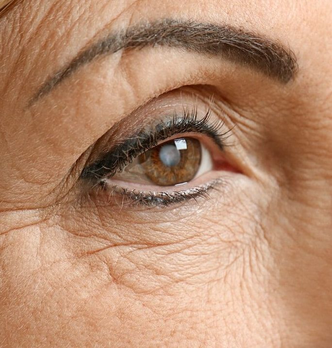 A Close Up of an Older Woman 's Eye With Wrinkles — Ian Emslie Optometrist In Warners Bay, NSW
