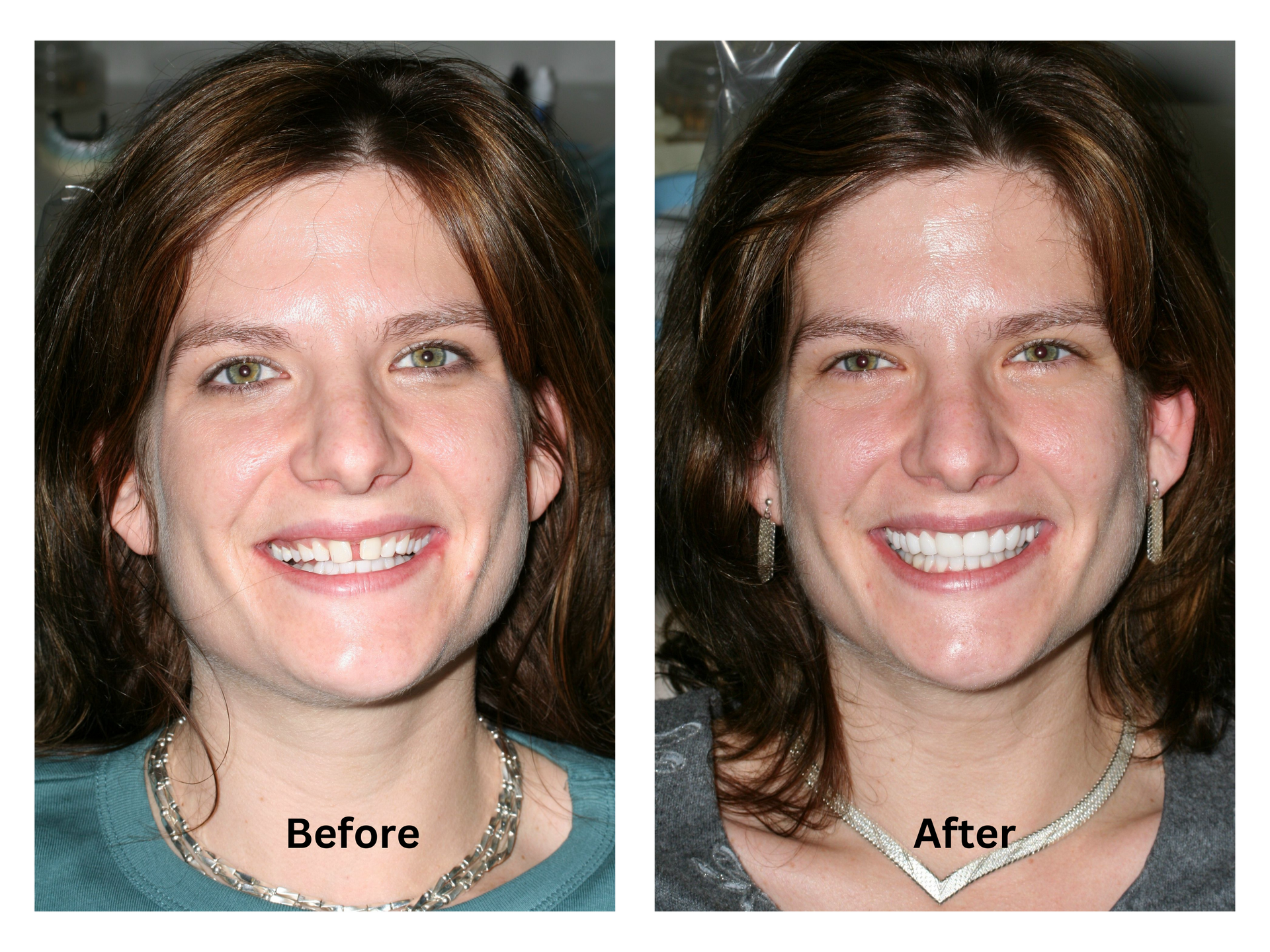 A before and after photo of a woman 's face