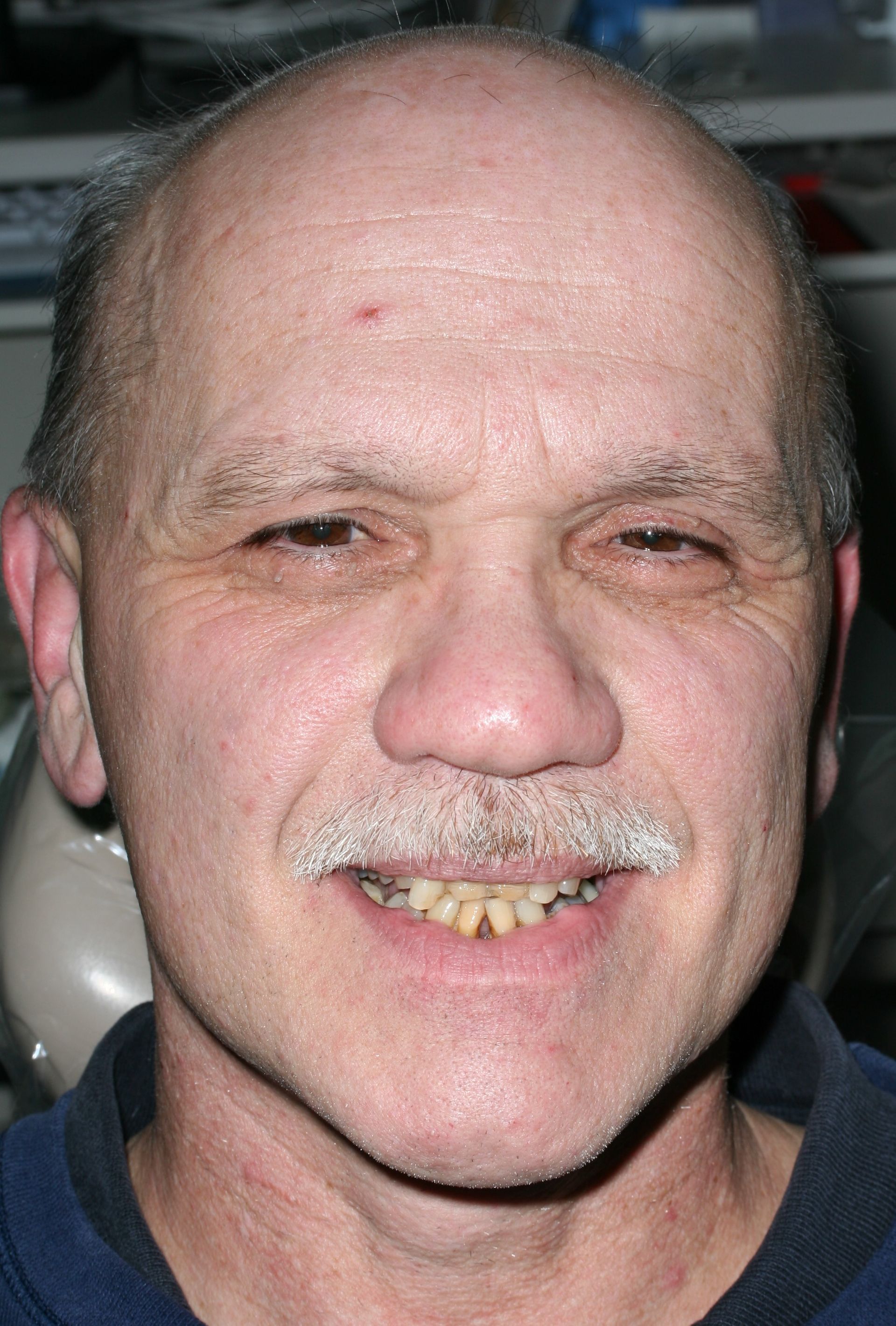 A bald man with a mustache is smiling for the camera.