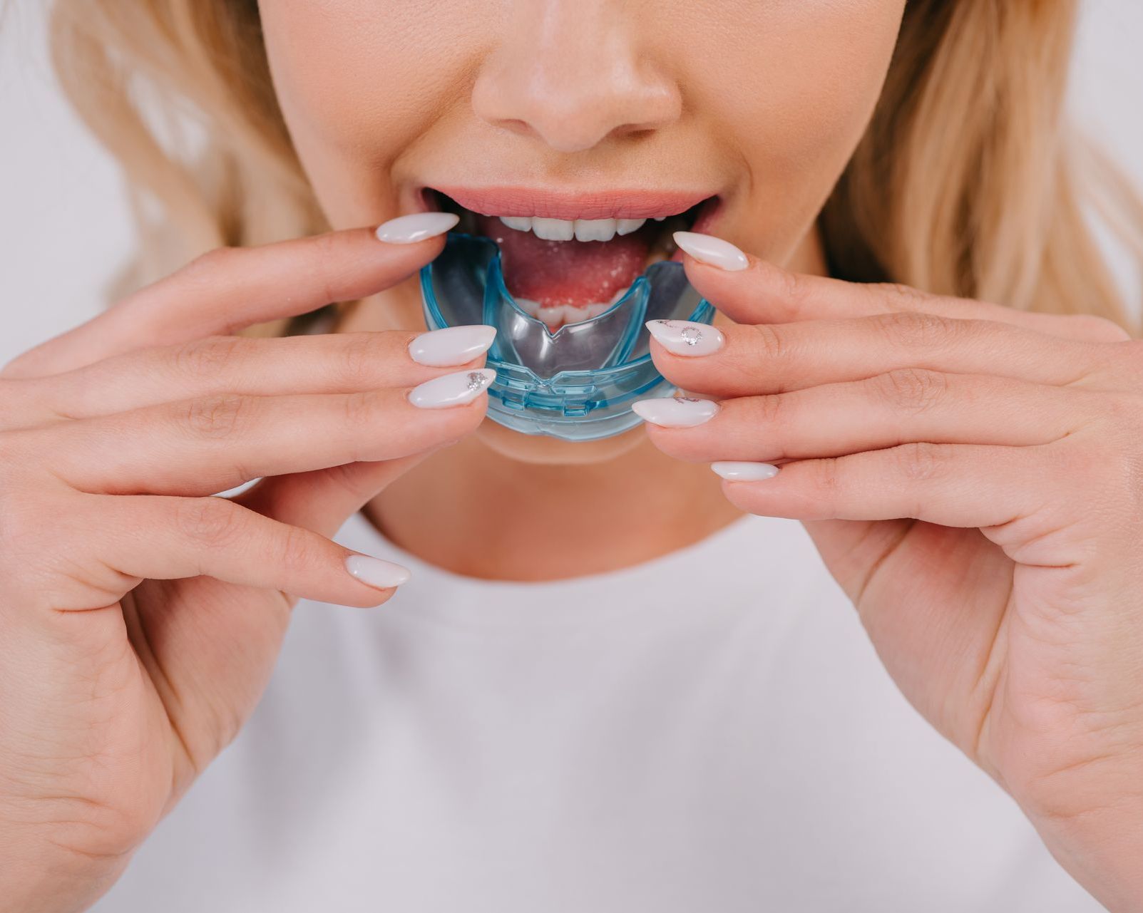 A woman is holding a blue mouth guard in her mouth.