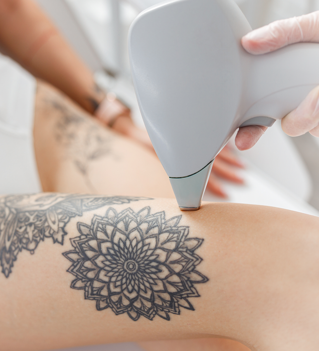 Removery - Ready to make a change and remove that unwanted tattoo? We have  you covered. Tap the link to book a free tattoo removal consultation and  get started on your journey