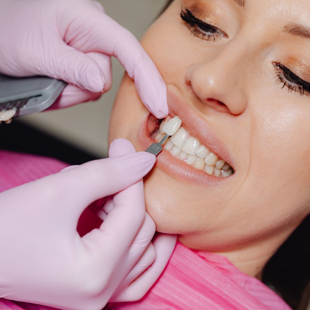 types-of-dental-crowns-and-their-uses-dentistry-at-consilium