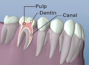 A diagram of a tooth showing the pulp , dentin , and canal.