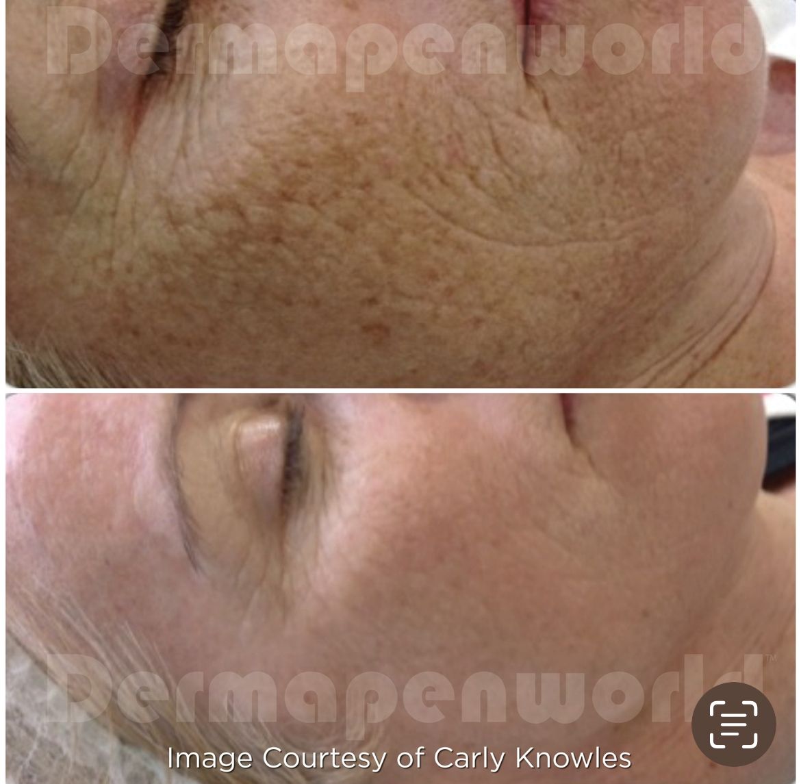 Ein Vorher-Nachher-Foto eines Frauengesichts, aufgenommen von Carly Knowles