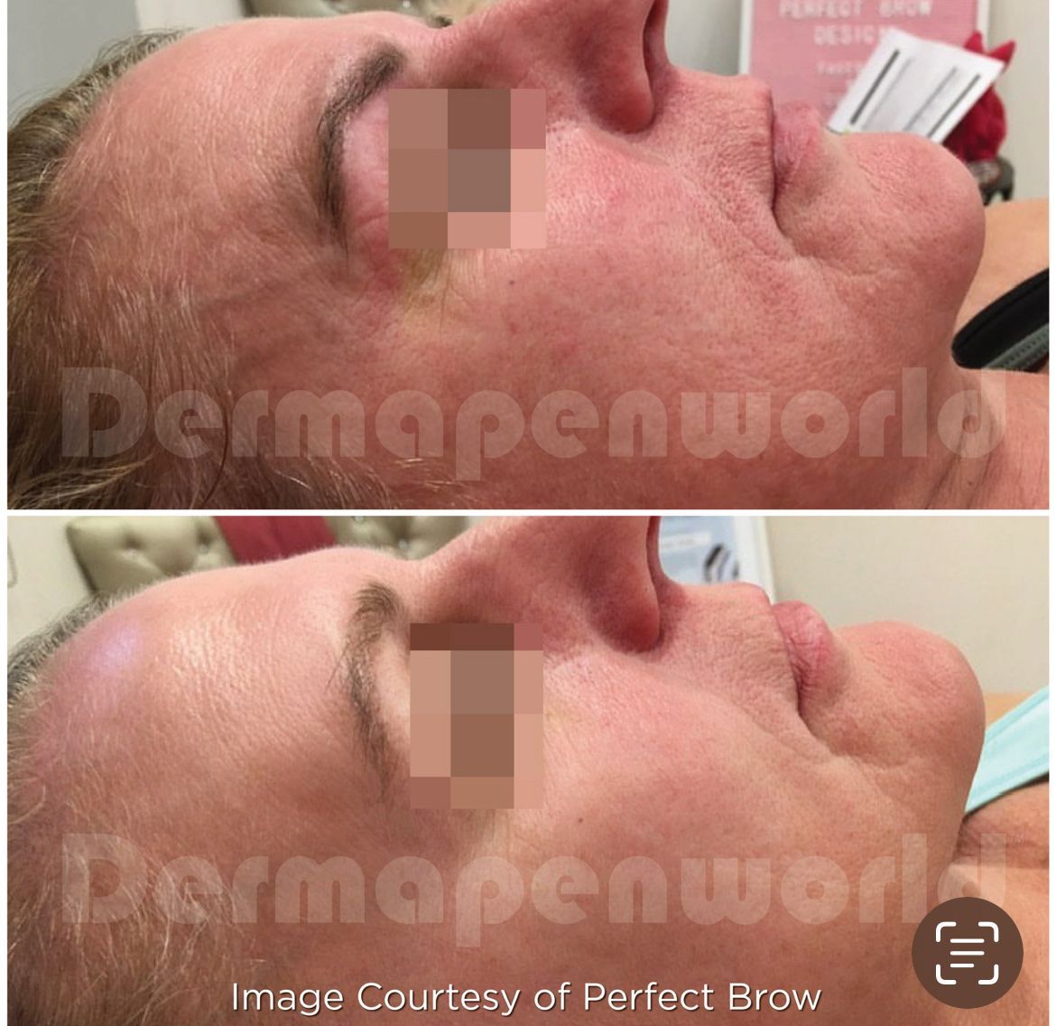 Ein Vorher-Nachher-Foto vom Gesicht einer Frau