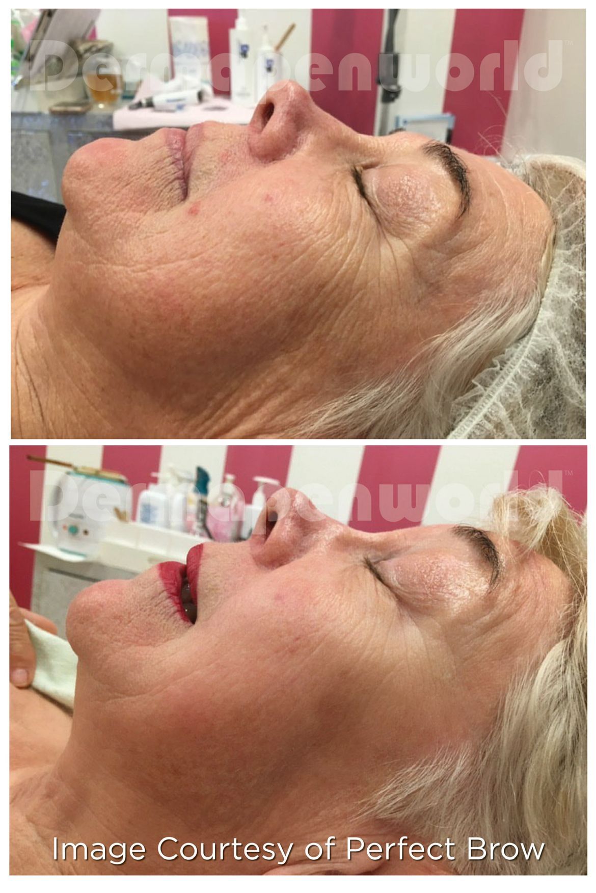 Ein Vorher-Nachher-Foto vom Gesicht einer Frau.