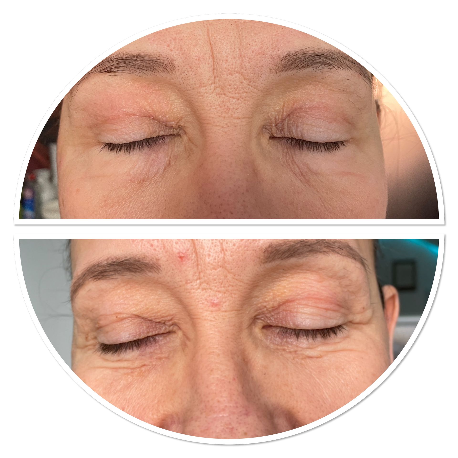 Ein Vorher-Nachher-Bild des Gesichts einer Frau mit geschlossenen Augen.