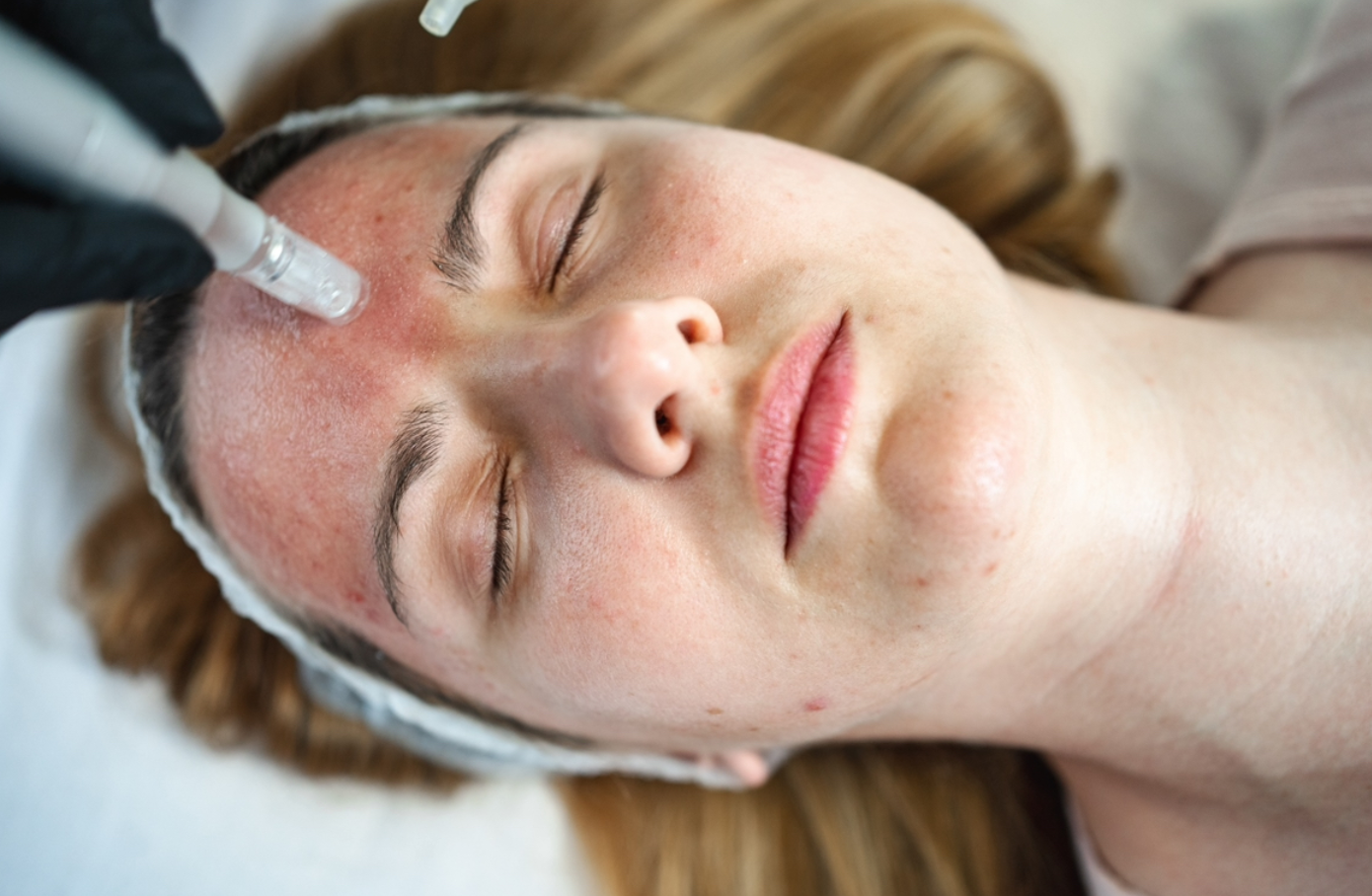 Eine Frau bekommt eine Gesichtsbehandlung für die Stirn.