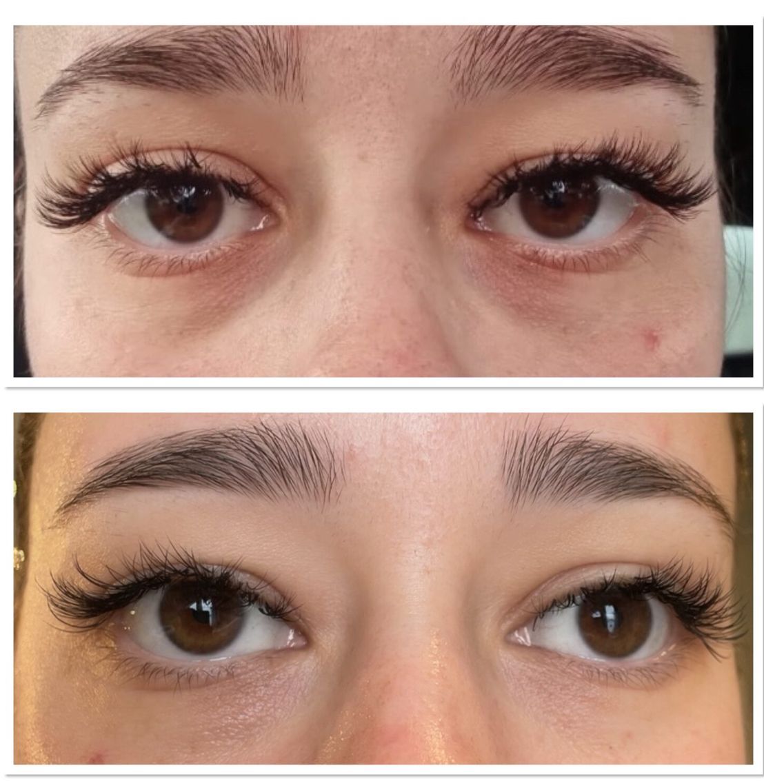 Ein Vorher-Nachher-Bild der Augen eines Mannes.