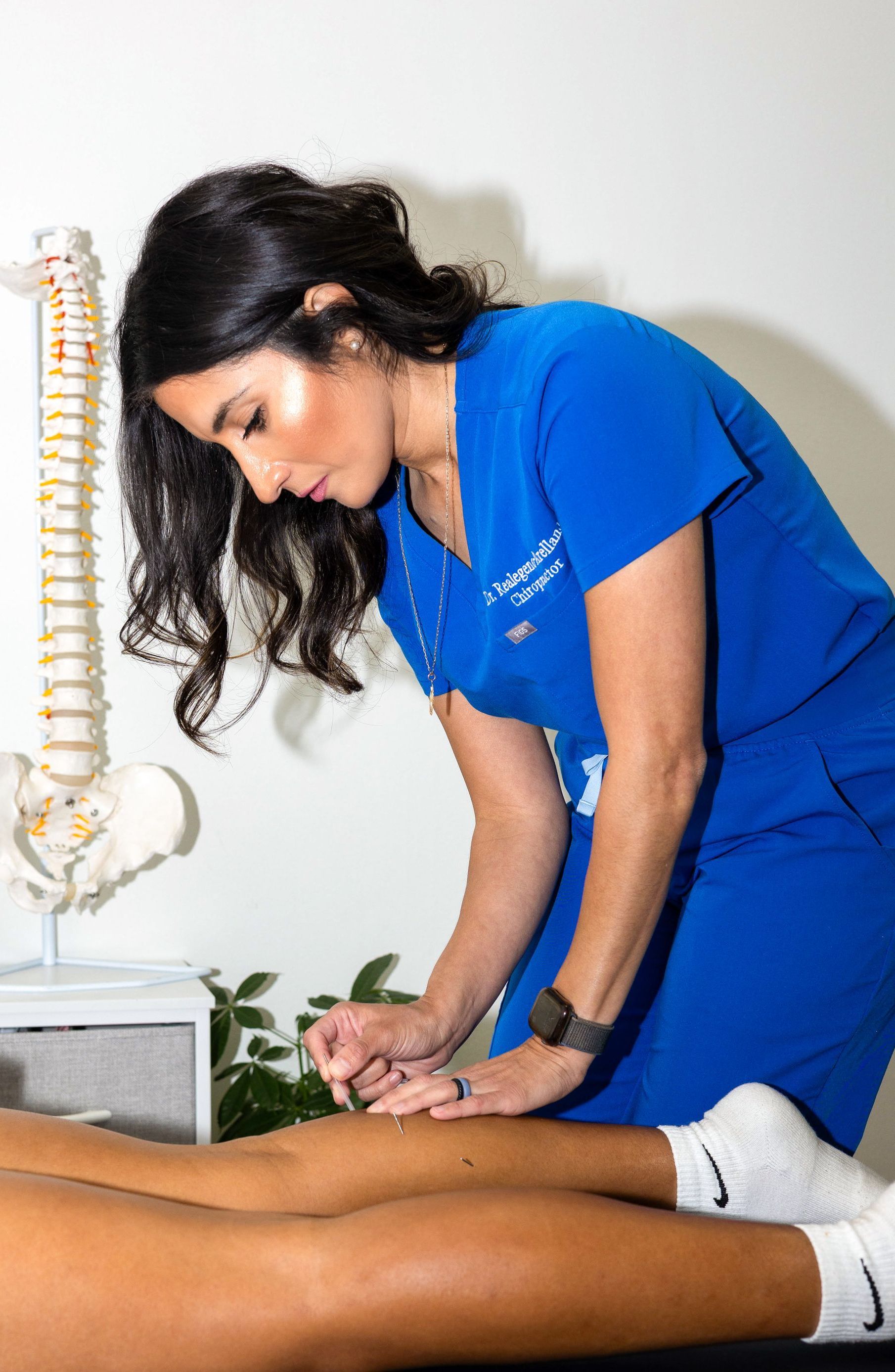 A person is getting a dry needling treatment on their back.