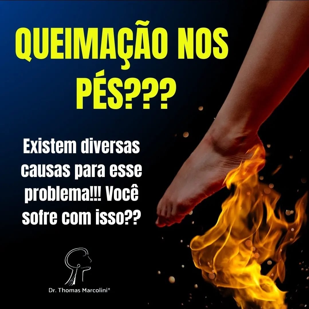 Como aliviar a queimação nos pés!