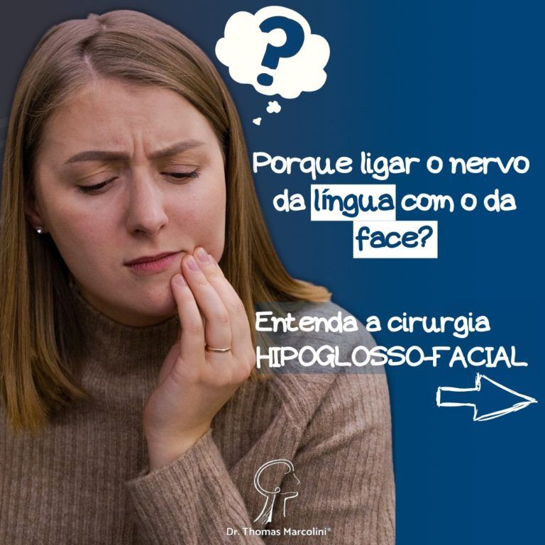 Cirurgia Hipoglosso-Facial – Utilizando O Nervo Da Língua Para Reinervar A Face!