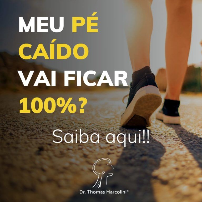 Pé caído fica 100%?