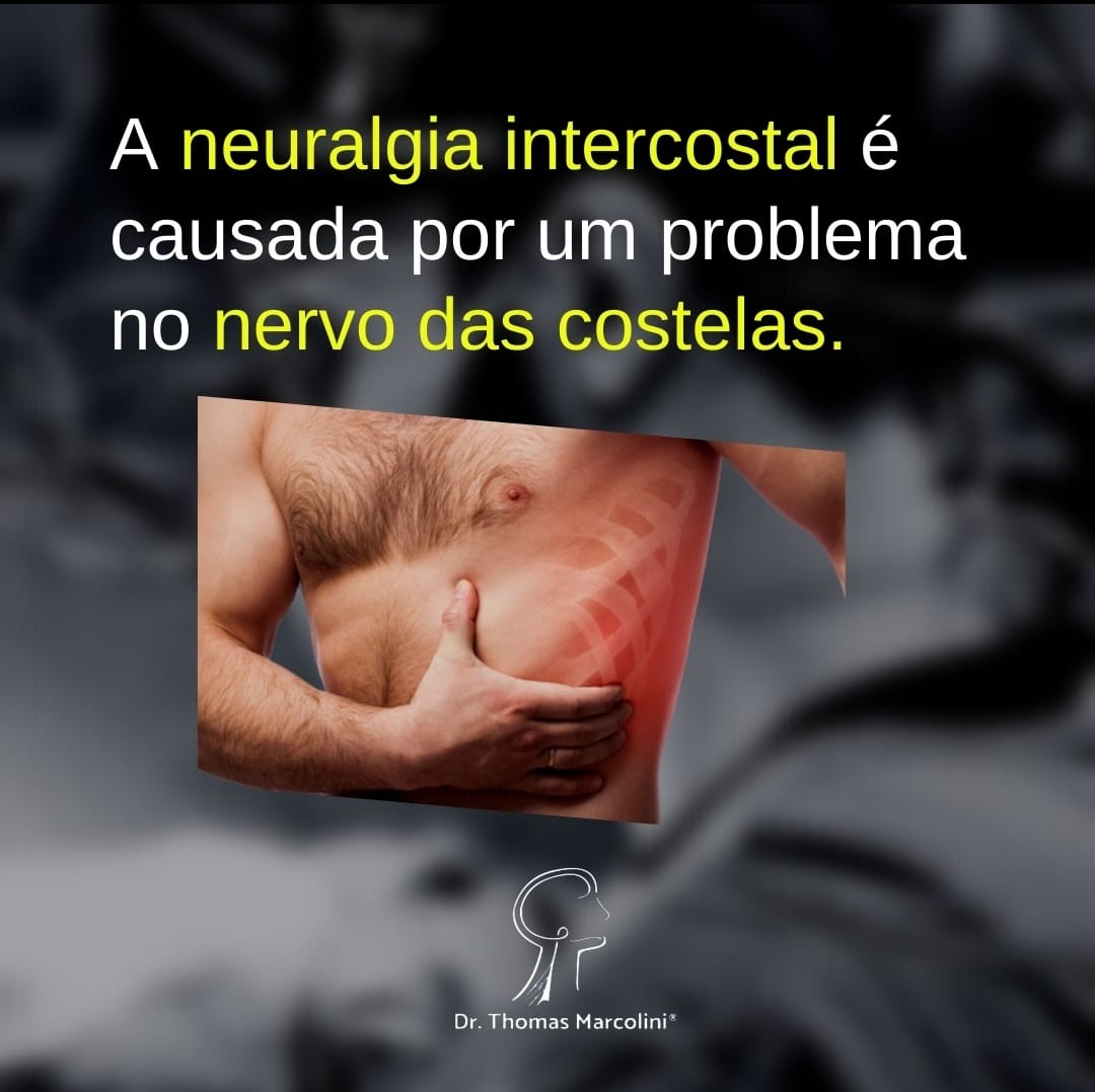 Neuralgia intercostal é causado pelo nervo das costelas.