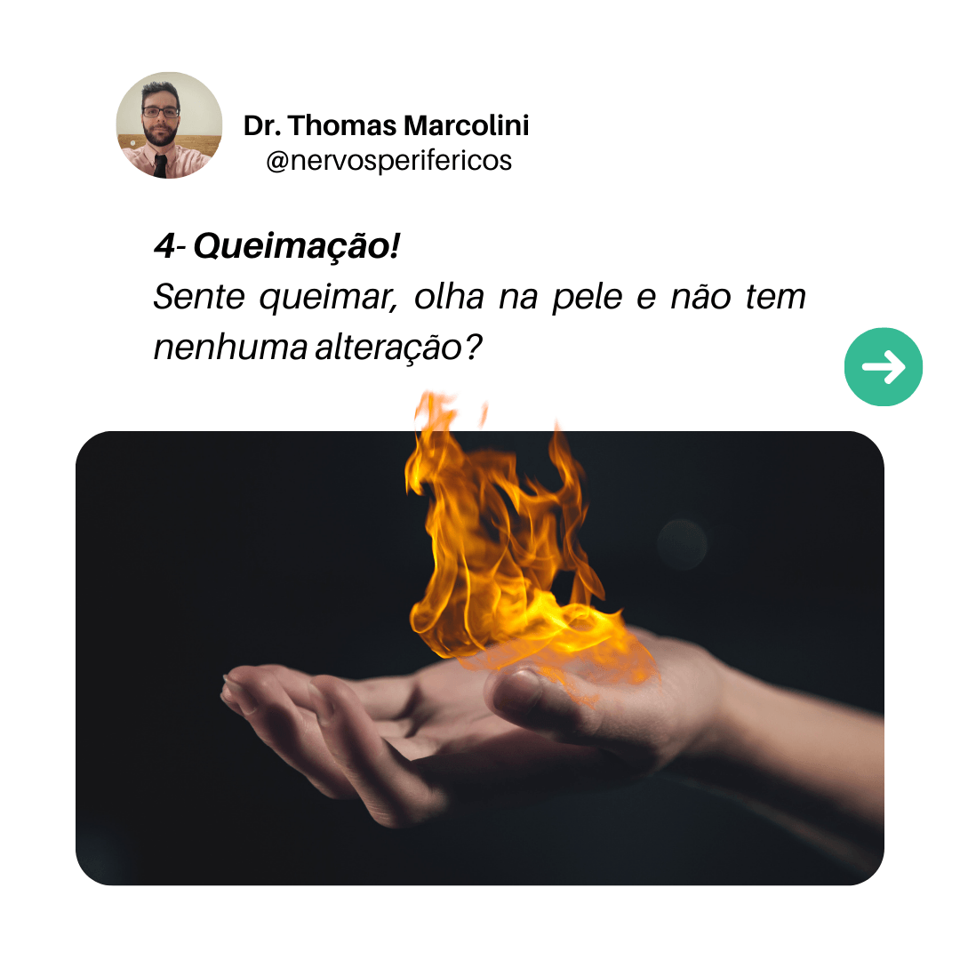 Queimação é um sintoma de problema de nervos