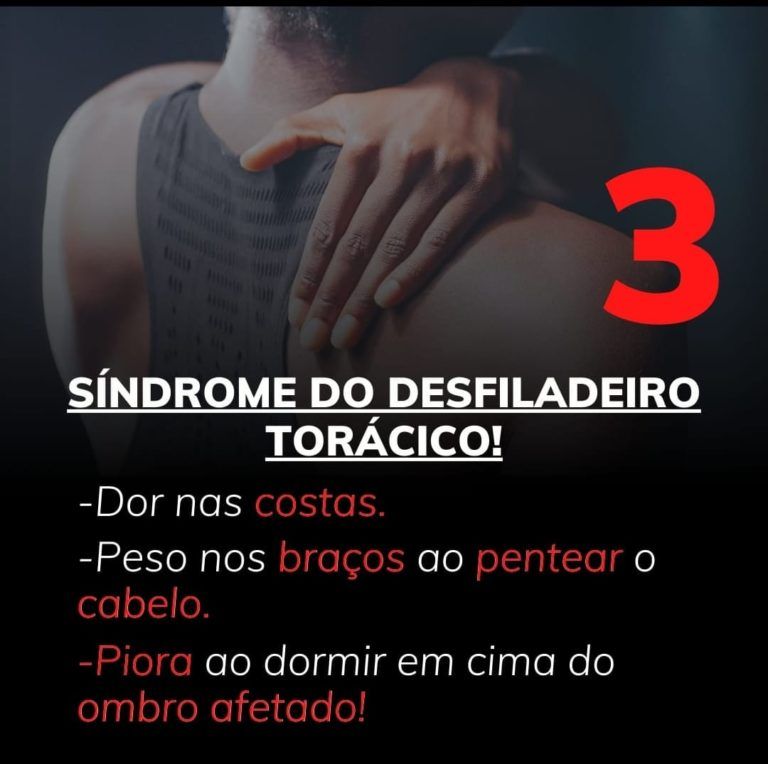 síndrome do desfiladeiro torácico causa formigamentos