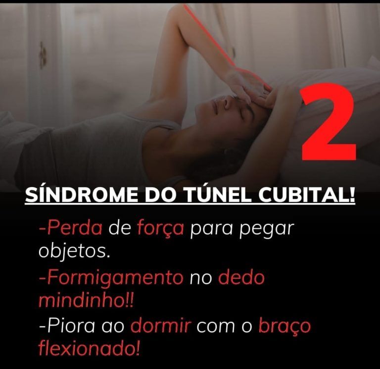 síndrome do túnel cubital