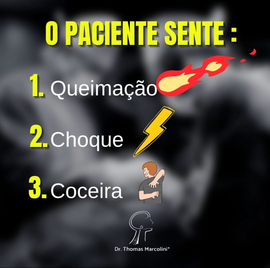 A neuralgia intercostal causa queimação, choque e coceira.